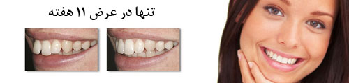 Protrusion