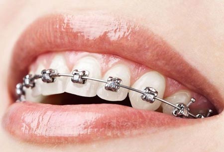 Teeth3