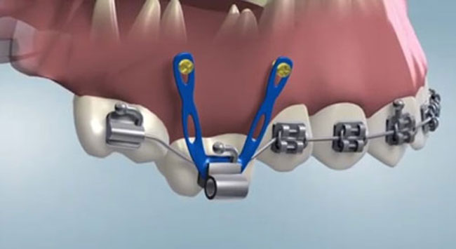 orthodontics